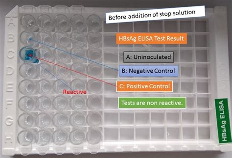 elisa test results interpreted